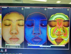 皮肤检测-光SPA科技美肤