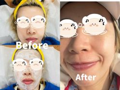 -洁铭新加坡医美