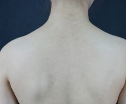 -厦门美莱整形美容医院