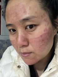 -空军总医院激光整形美容中心