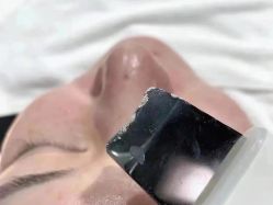 -美肤盾祛痘·问题肌头疗管理中心