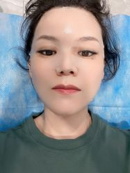 体验后-大连美天医疗美容医院