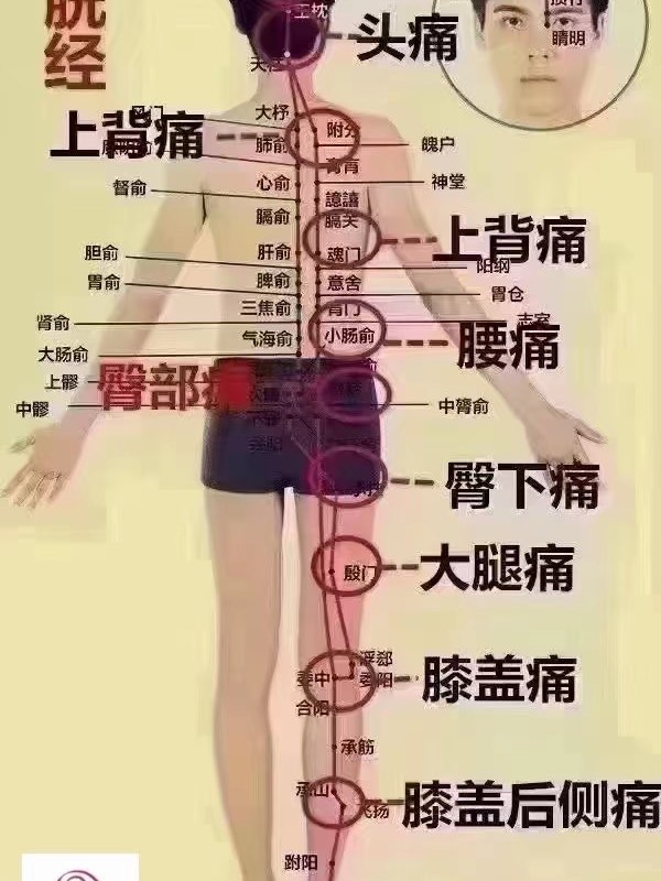 后背涨痛位置图详解图片