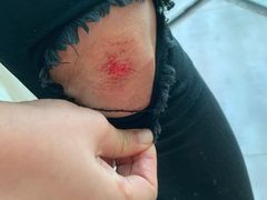 -合肥滨湖国家森林公园