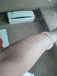 体验后-肌理言健康美肌驻颜所