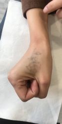 -天道专业洗纹身