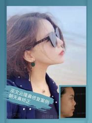 -北京米扬丽格医疗美容·联合丽格鼻整形中心