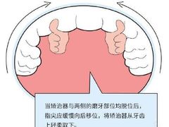 -团圆口腔·种植中心(锦江院区)