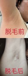 -南宁维密整形·王敦华眼鼻整复中心