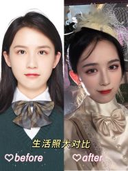 -Yestar宁波艺星整形医院