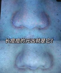 -+MS卓美丝专业祛痘·皮肤管理中心