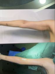 点击看大图 -郡艺医疗美容·微整·眼鼻吸脂