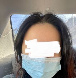 点击看大图 体验后-深圳艺星医疗美容医院