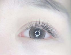 -初樱科技美学问题肌修复中心