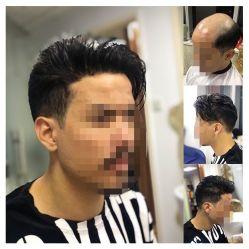 -发饰美男士增发补发假发定制店