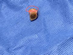 -安徽医科大学第一附属医院(绩溪路院区)