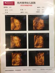 -杭州贝瑞斯美华妇儿医院·早孕·产检·儿科