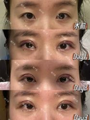-Yestar艺星整形美容医院
