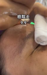 -痘院士祛痘美容皮肤管理