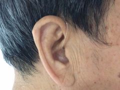 -宁耳听力助听器奥迪康峰力西门子斯达克(静安闸北店)