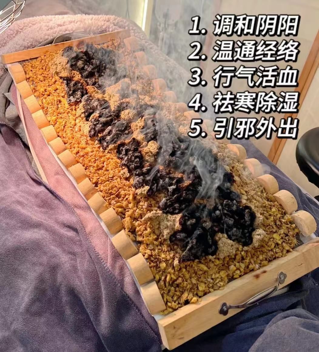 铺姜灸可以温经散寒,活血化瘀,祛风除湿