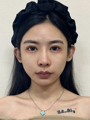 -四川米兰柏羽医学美容医院