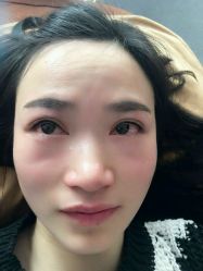 -郡艺医疗美容·微整·眼鼻吸脂