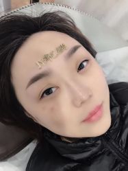 点击看大图 -郡艺医疗美容·微整·眼鼻吸脂