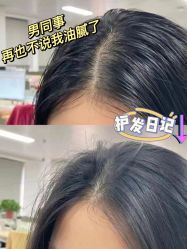 -润复丝·泽发防脱头皮管理