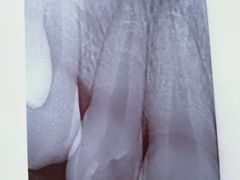 -杨浦区牙防所(中原门诊部)