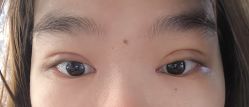 体验后-天津伊美尔医疗整形美容专科医院