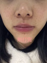-杭州医巢医疗美容