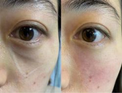 -云南吴氏嘉美医疗美容医院