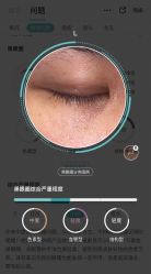 体验前-SKINIST丽铂医疗美容