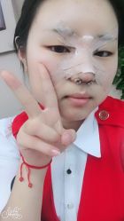 点击看大图 体验后-鑫元辰医疗美容整形
