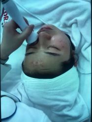 点击看大图 -痘敏医生专业祛痘连锁