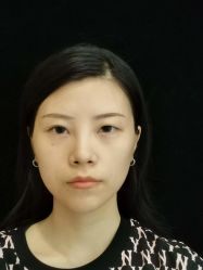 -素美医疗美容·西南眼鼻整形·修复基地