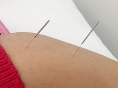 -上海市杨浦区中医医院