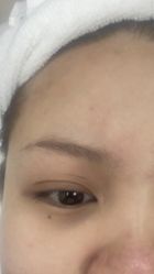 -深圳春天阳光医院·轮廓抗衰中心