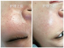 -苗方清颜痘肌研究所