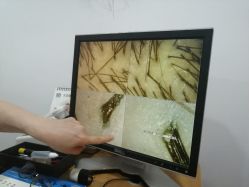 -章光101防脱养发荟