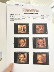 -艾博尔医院