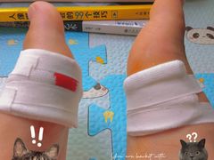 -重庆医科大学附属第一医院(本部)