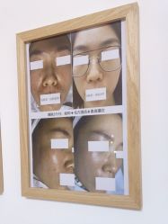 -美肤盾祛痘·问题肌头疗管理中心