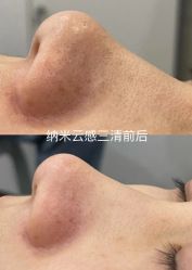 -SKIN79皮肤管理中心