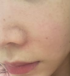 -慕颜医疗美容·皮肤微整 抗衰