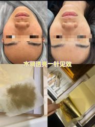 -SKIN79皮肤管理中心