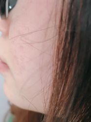 -广州美莱医疗美容医院