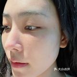 深圳｜做了一次黑眼圈的效果 一顿饭钱
