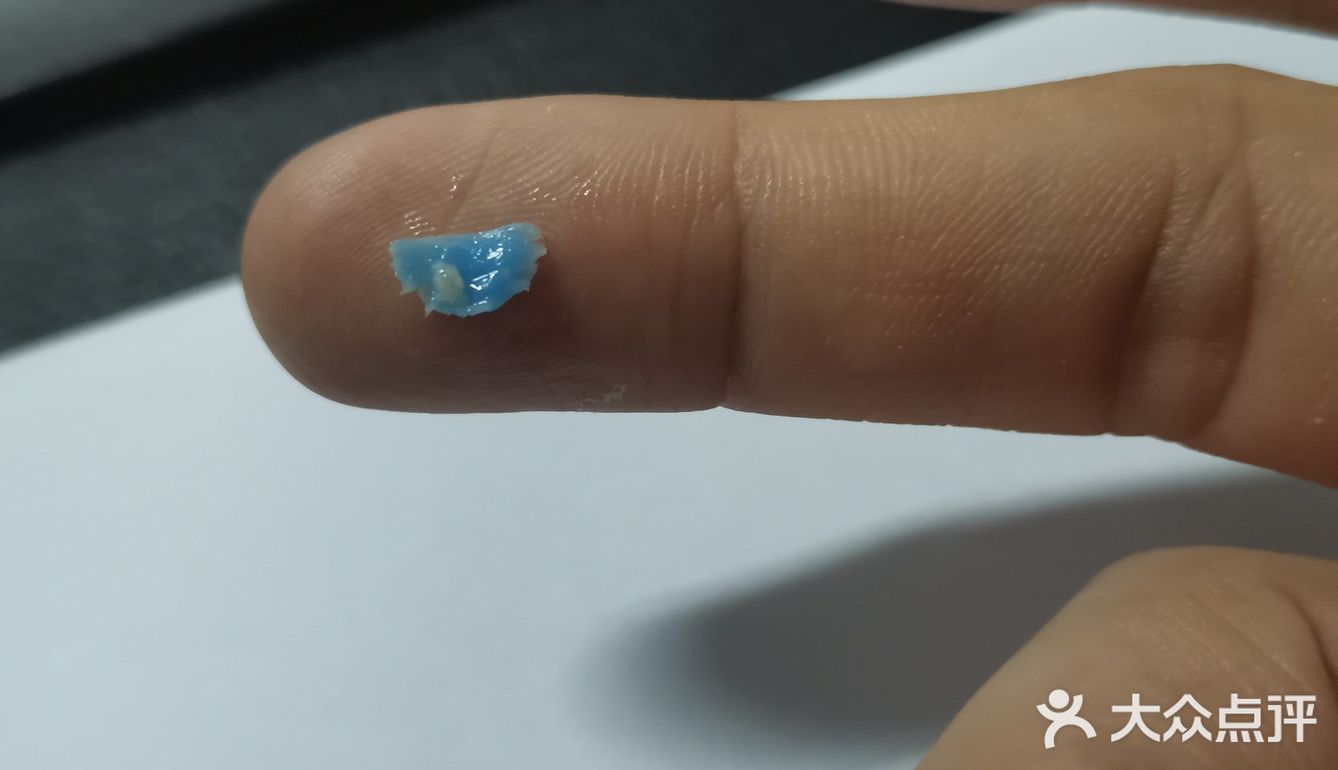 吃生煎吃出个不明物体[发呆]